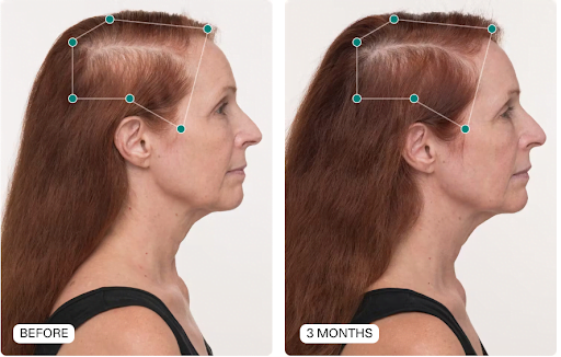 NUTRAFOL | Women's Hair Growth Nutraceutical