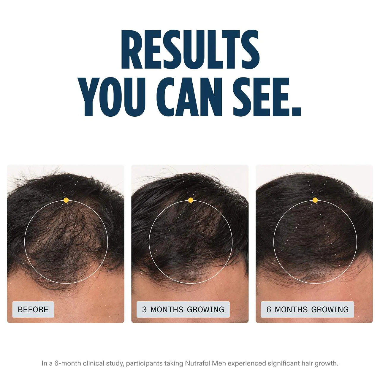 NUTRAFOL | Men's Hair Growth Nutraceutical
